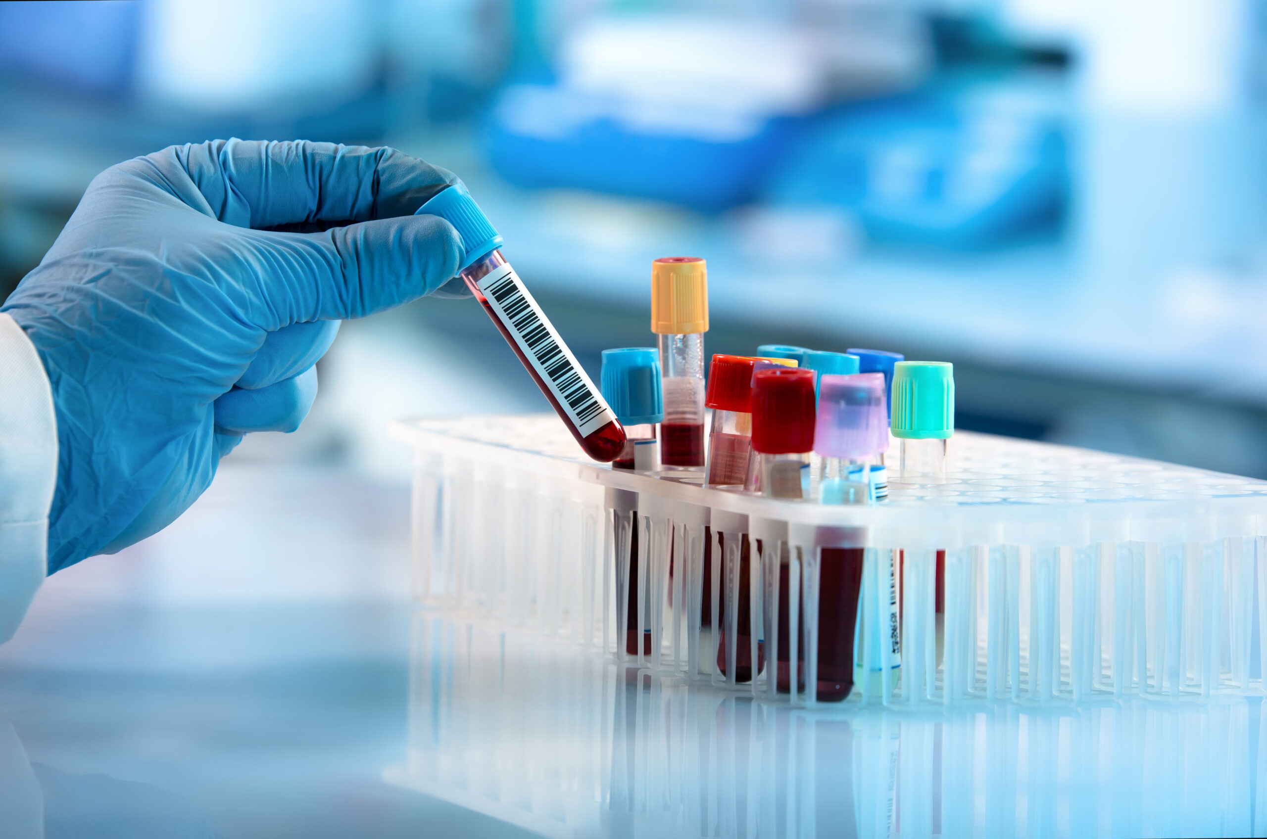 Researcher with gloved hand placing a test tube filled with blood into a vial holder.
