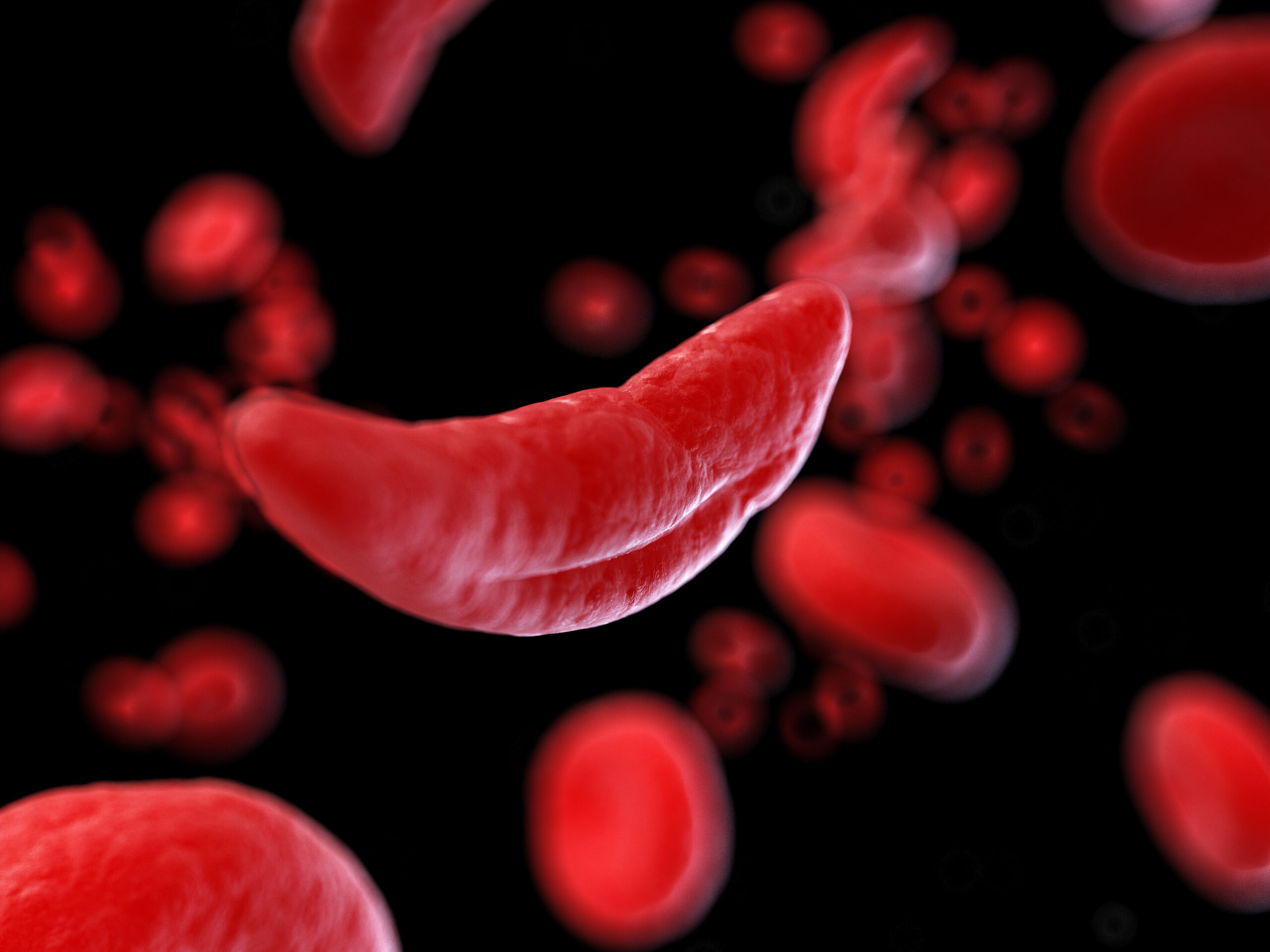 3D rendering of Sickle Cells on red background